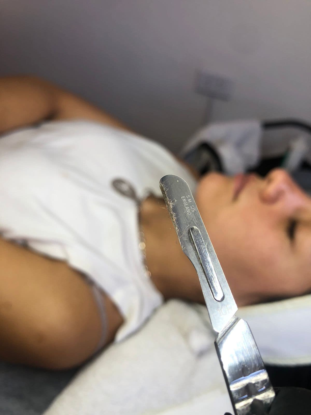 LIMPIEZA FACIAL CON DERMAPLANING