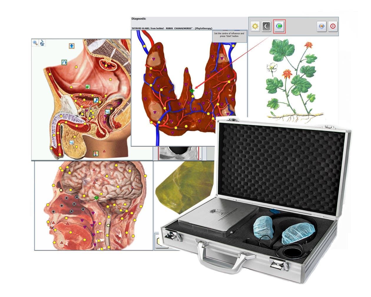 Protocolo de inicio: Diagnóstico NLS + Terapia Cuántica