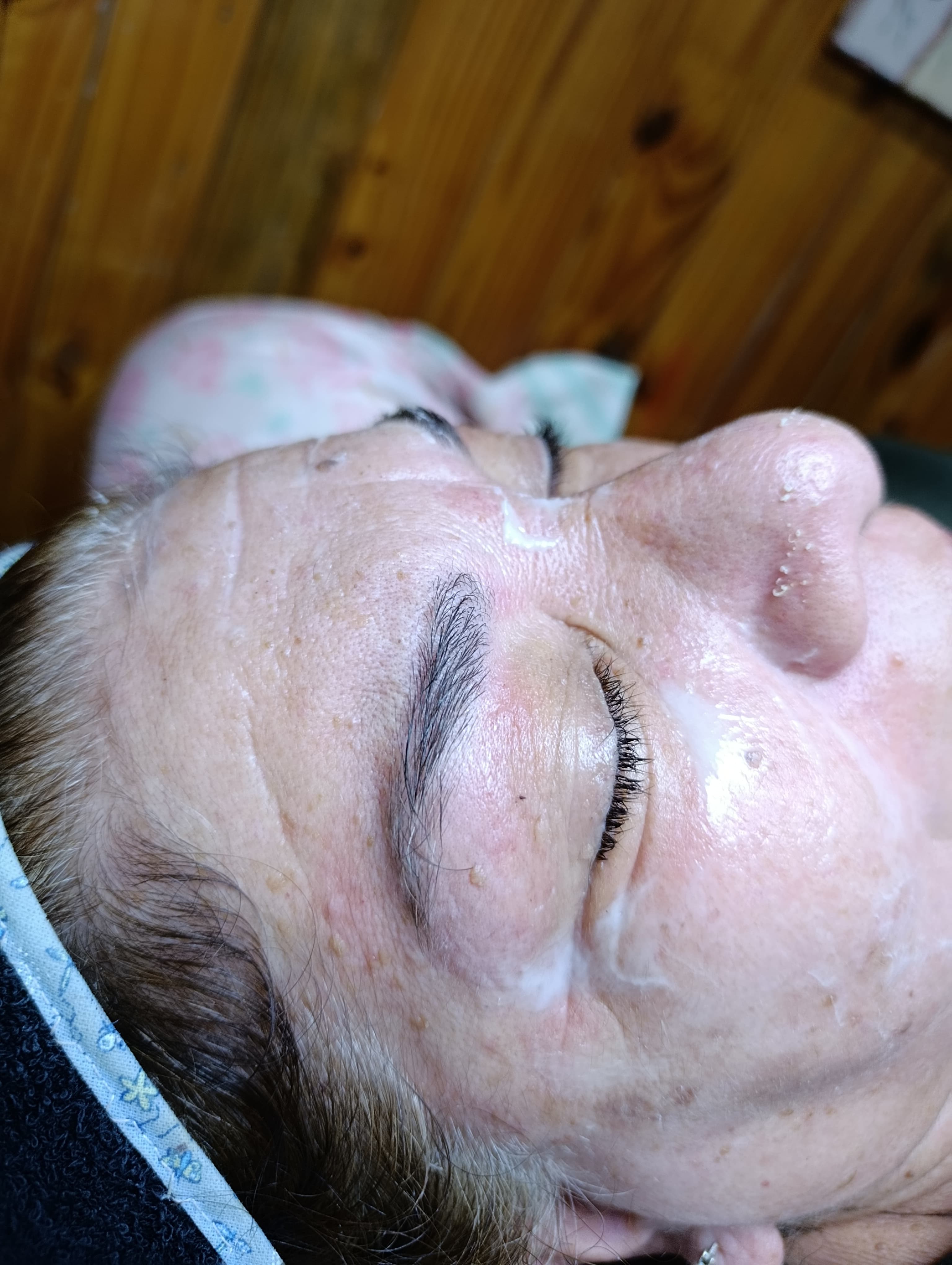 Limpieza facial profunda