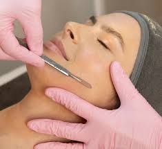 Dermaplaning glow