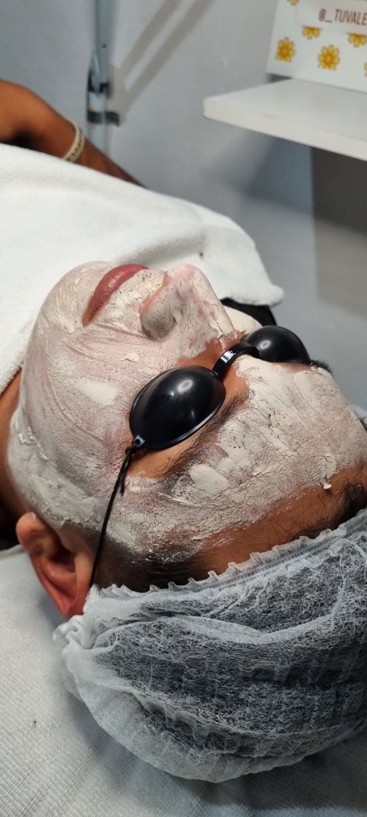 Tratamiento para ACNE