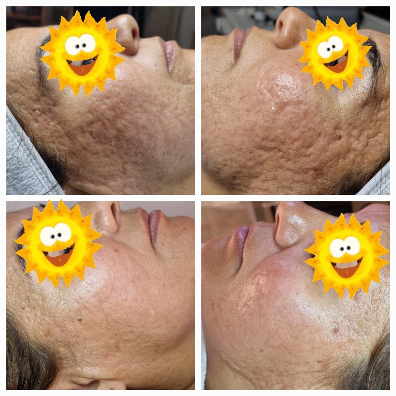 Facial COLAGENO ACTIVO
