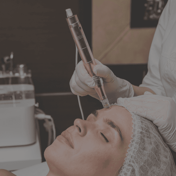 Microneedling: Inducción de Colágeno