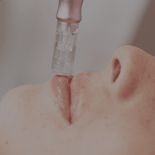Hydra lips