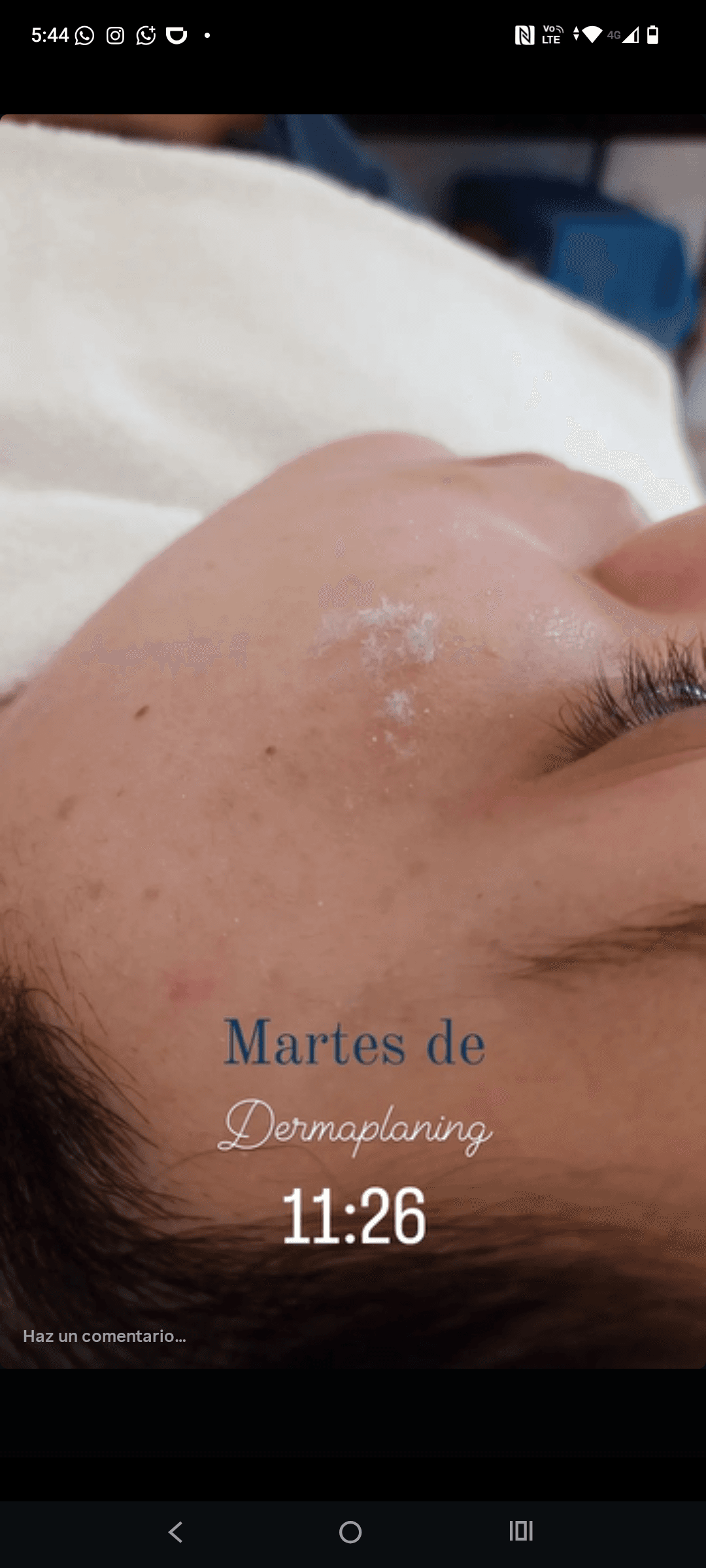 Higiene profunda + DERMAPLANING 🫧