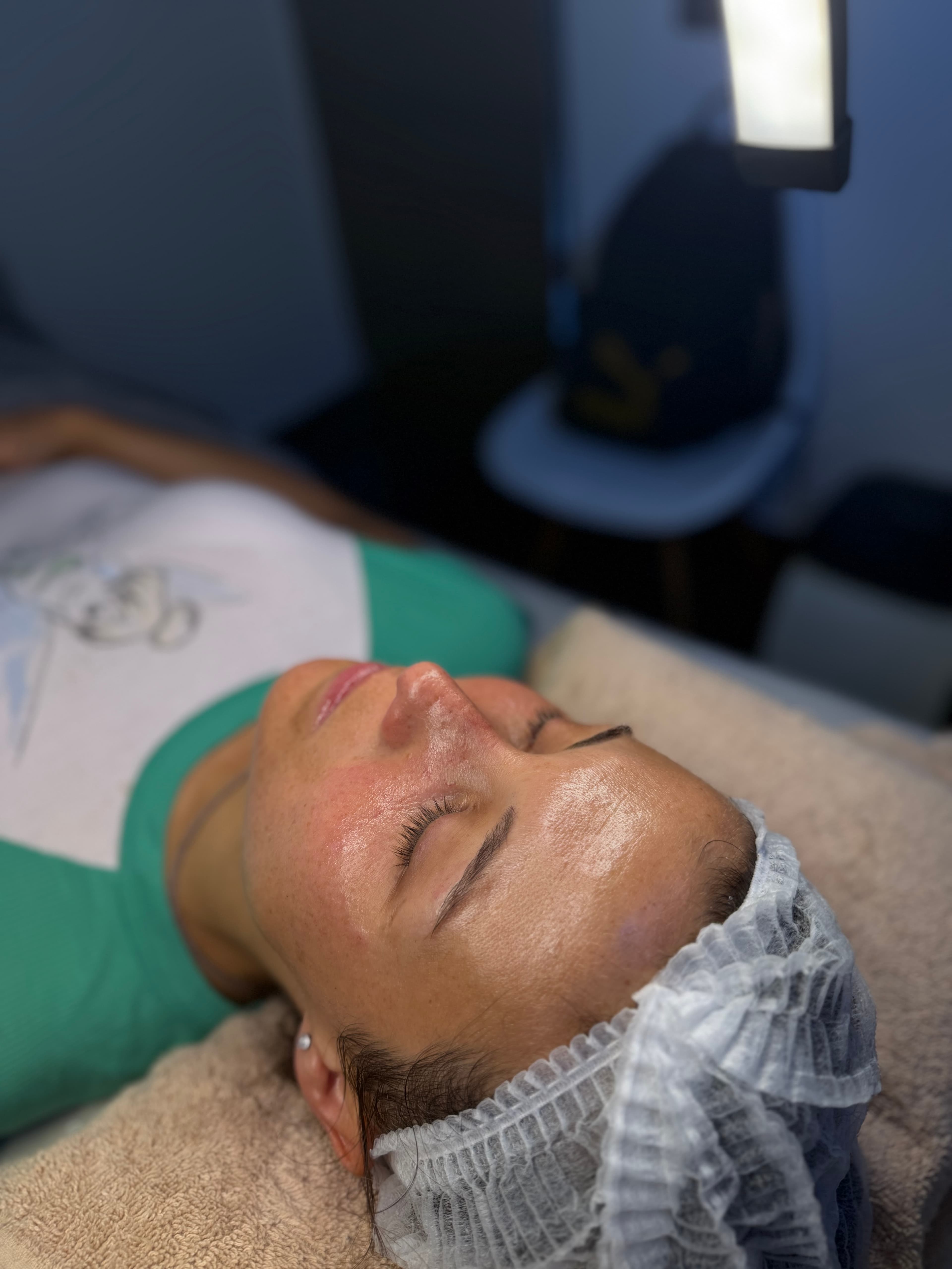 Limpieza facial profunda