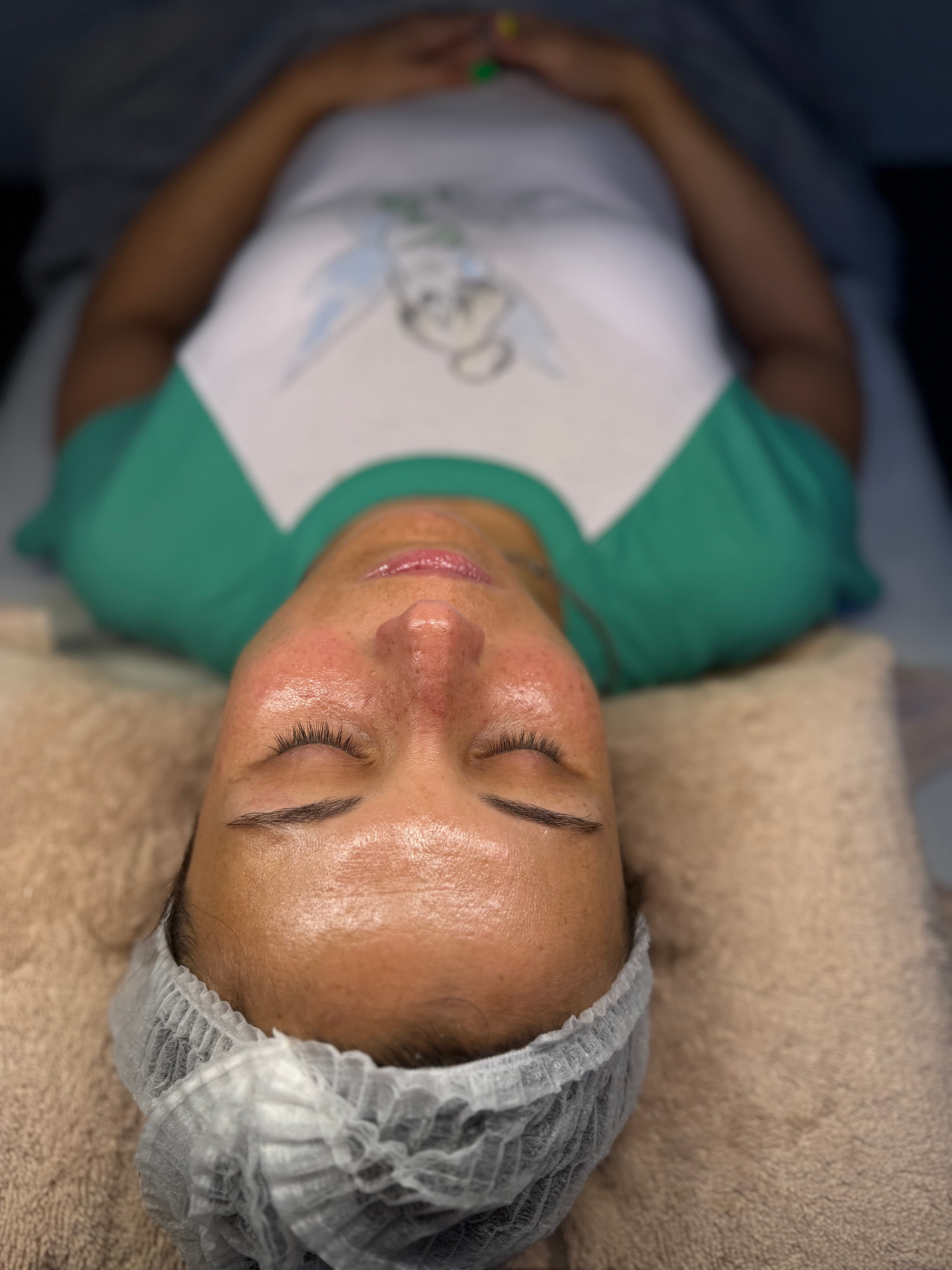Dermaplaning glow