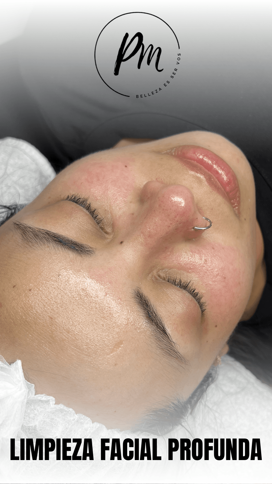 Limpieza facial profunda