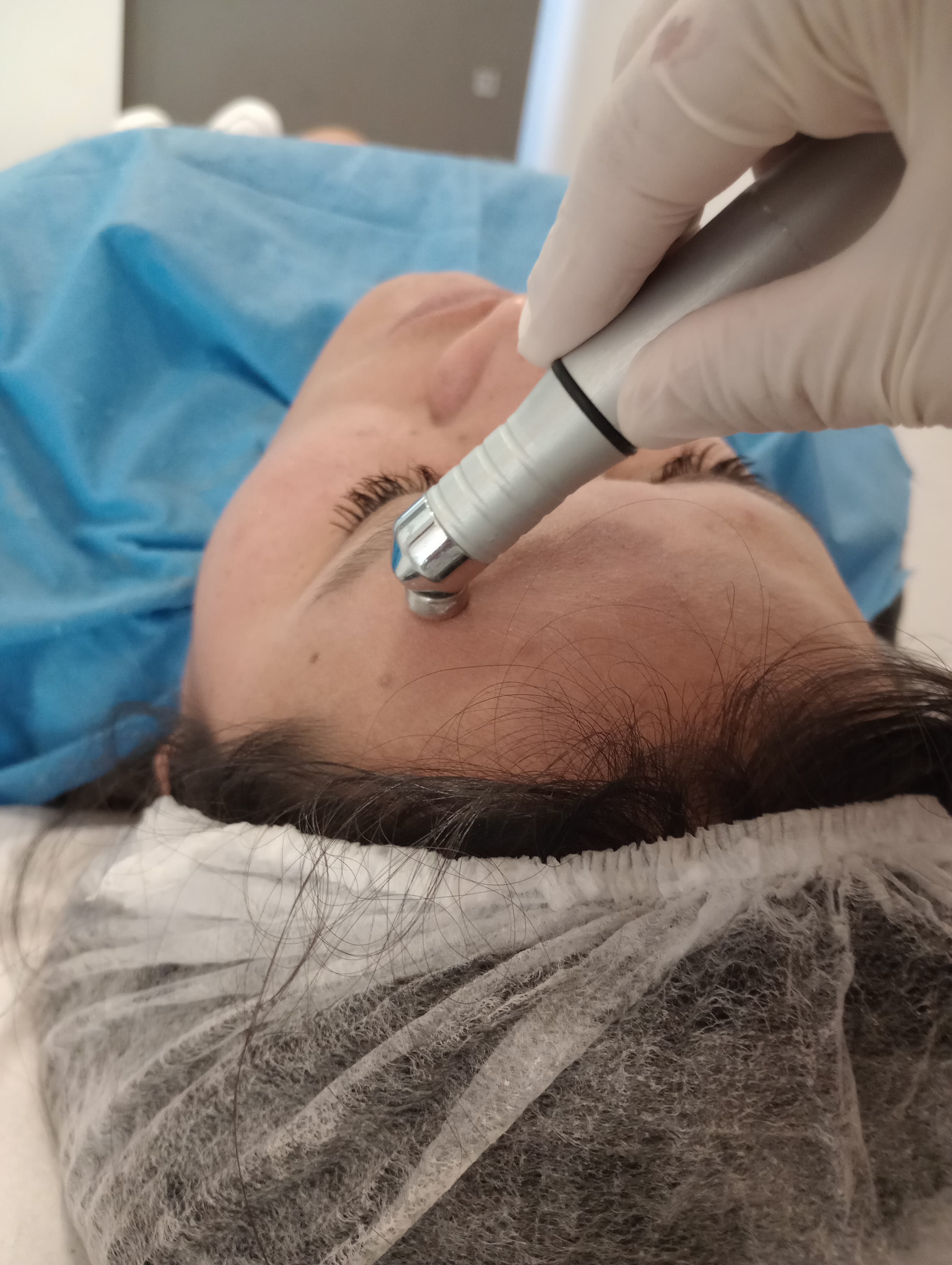 Facial Antiage