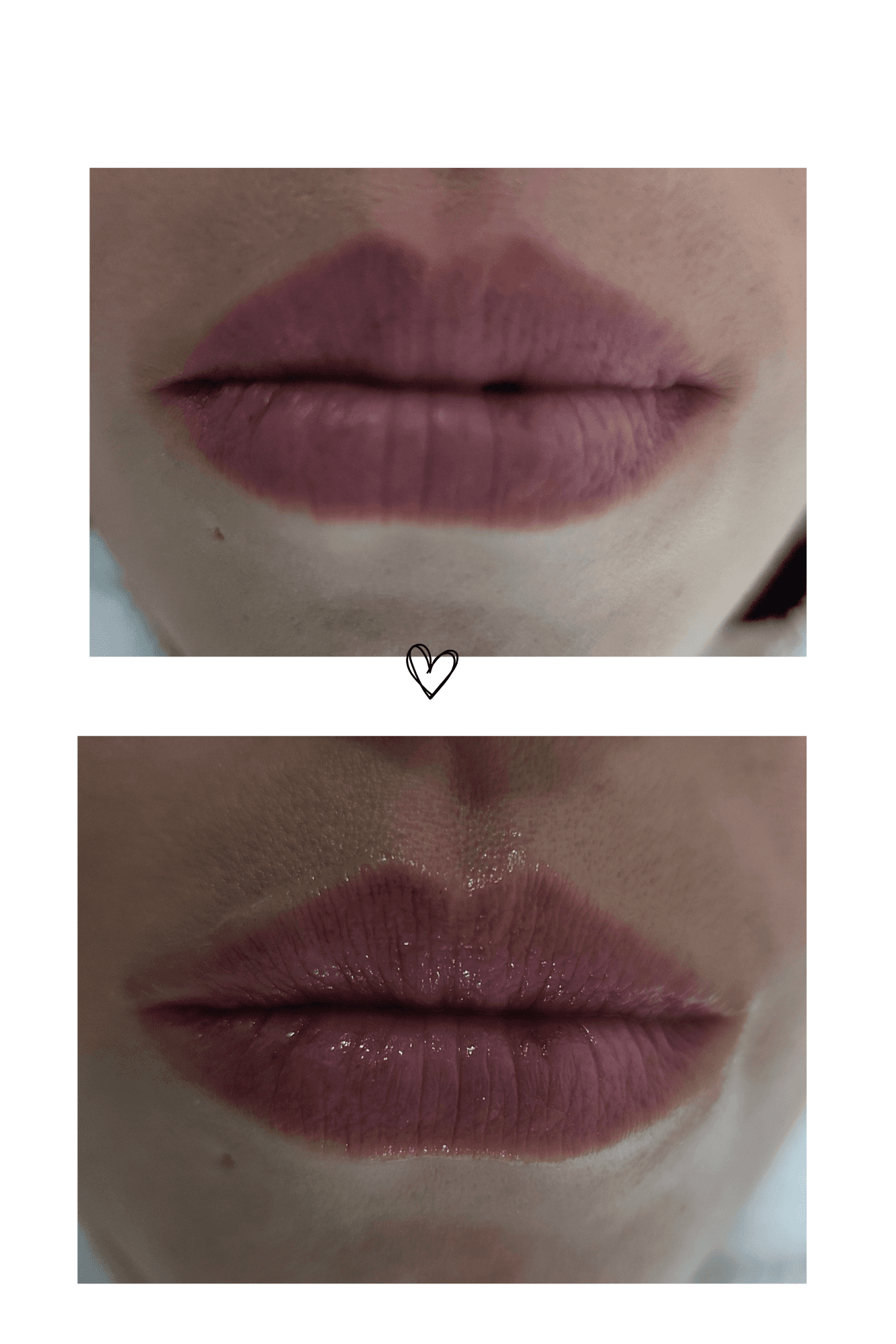 🌛 FACIAL 🌜 Peeling de labios 💋