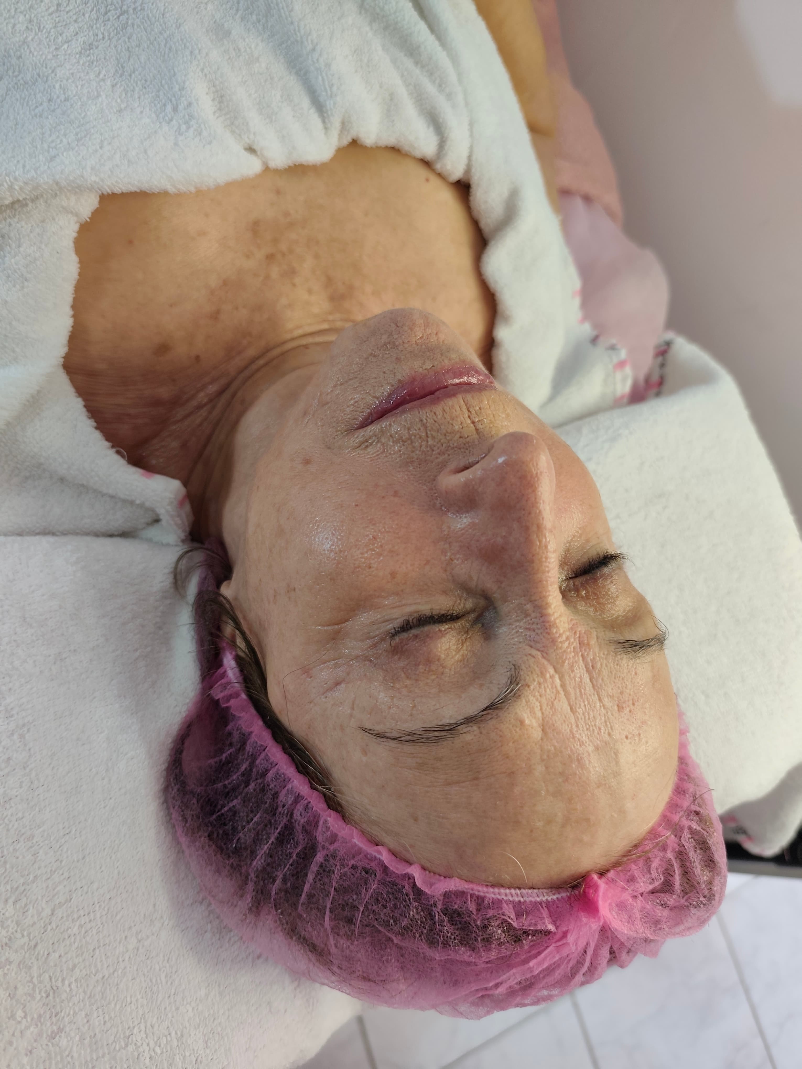 🌛FACIAL🌜 Peeling facial