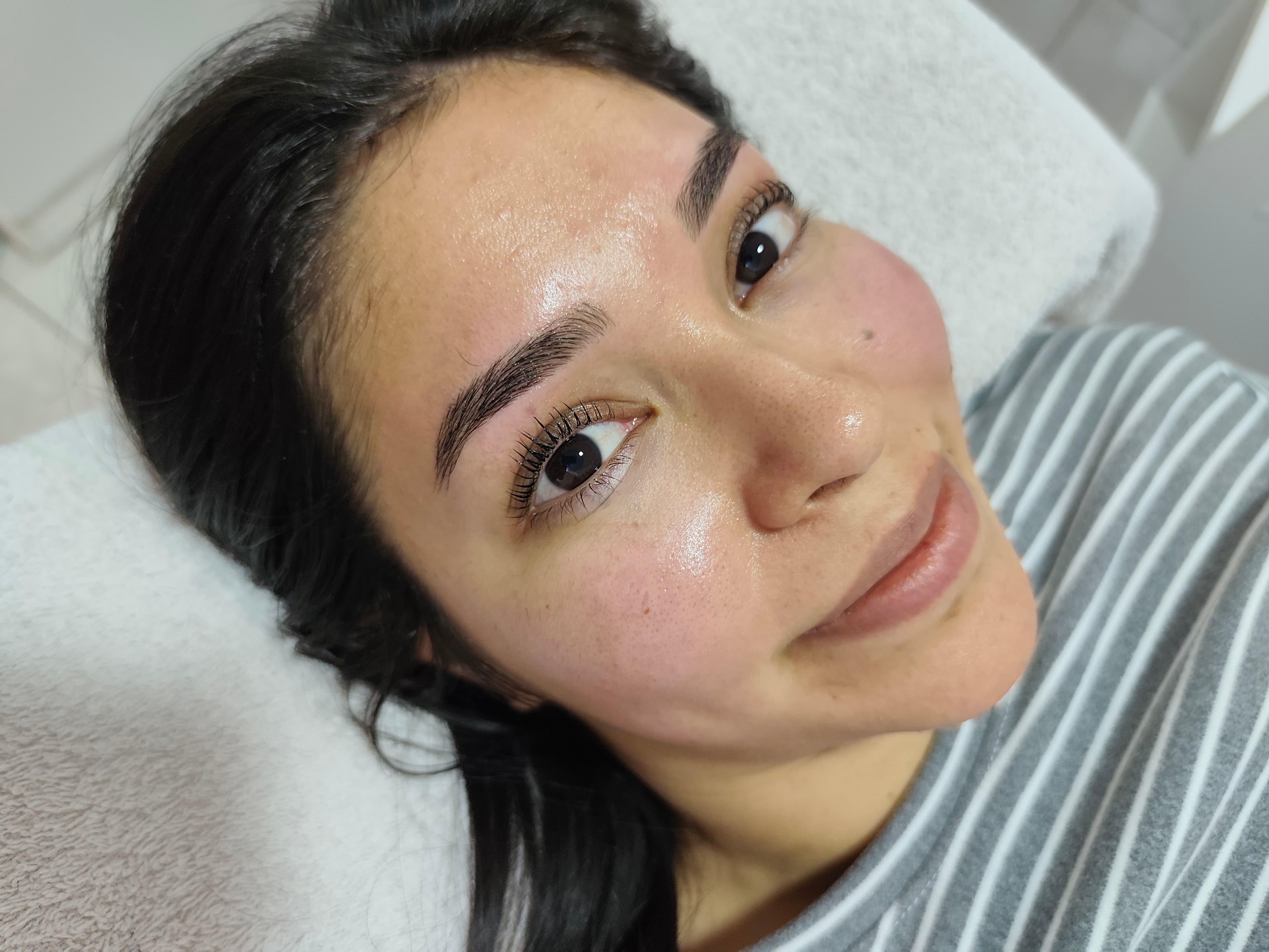 🌛FACIAL 🌜Peeling de ojeras 🫩