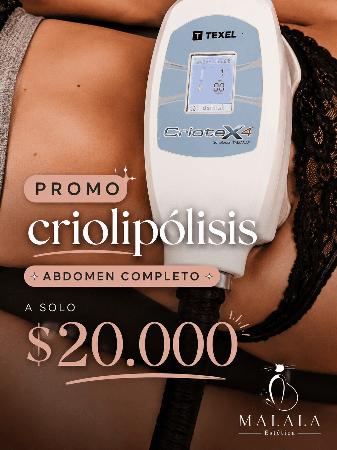 Criolipolisis abdomen 