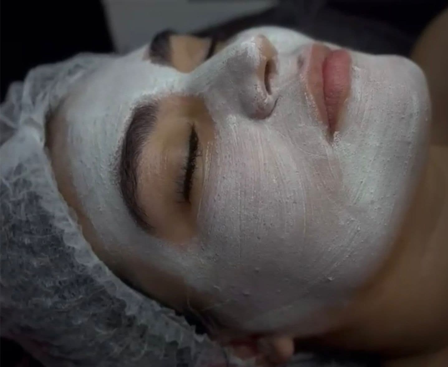Limpieza facial profunda