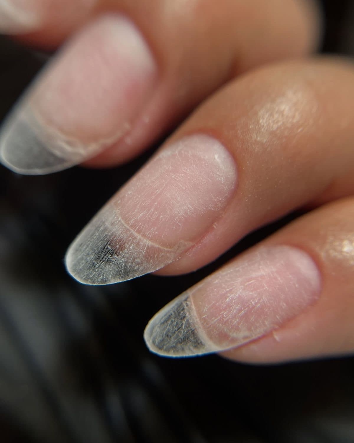 Soft Gel