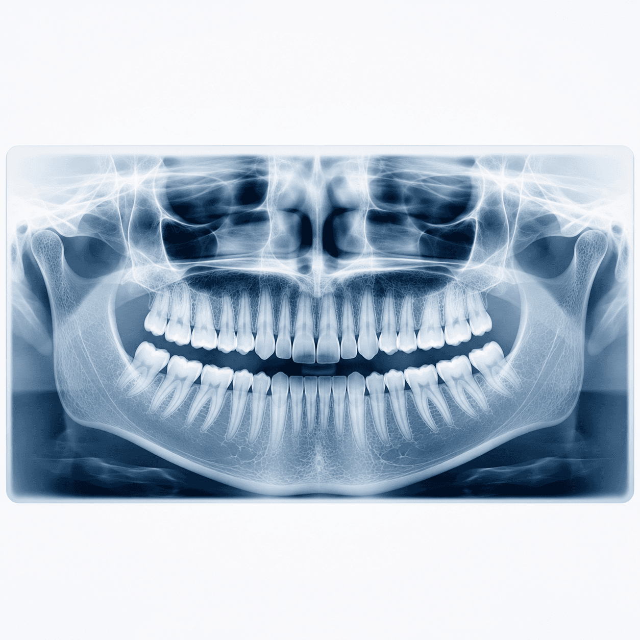 Radiografia Panoramica