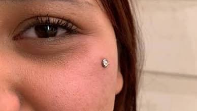 Microdermal facial