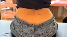 Microdermal corporal