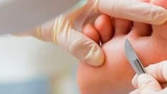PIES - pedicuria sin esmaltar