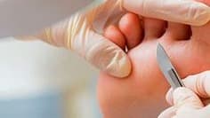 PIES - pedicuria con esmaltado