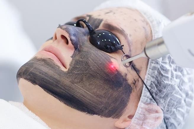 Hollywood Peel