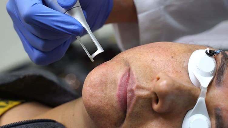 Picosure