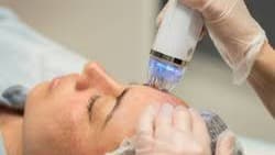 Radiofrecuencia fraccionada hifu 24D (Microneedle)