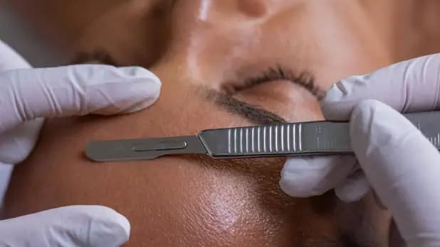 Dermaplaning