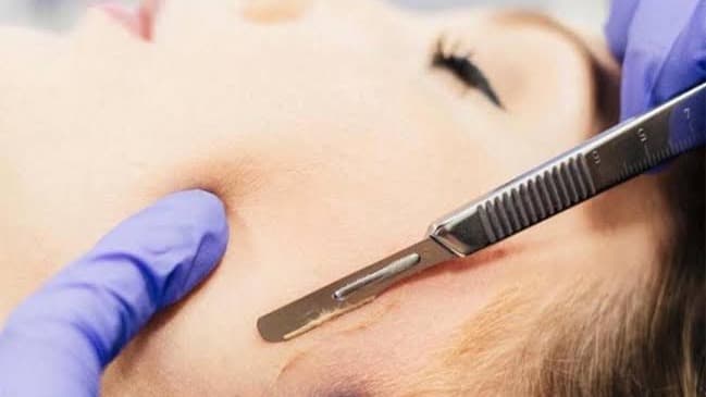 Dermaplanning
