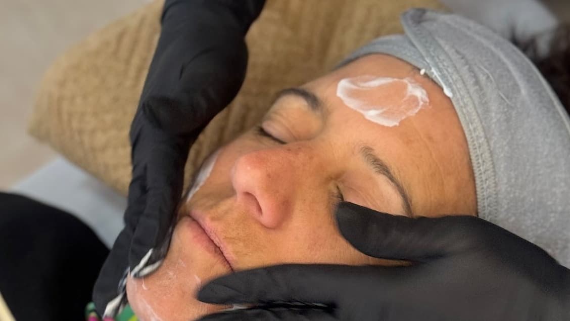 Limpieza facial con extracciones 