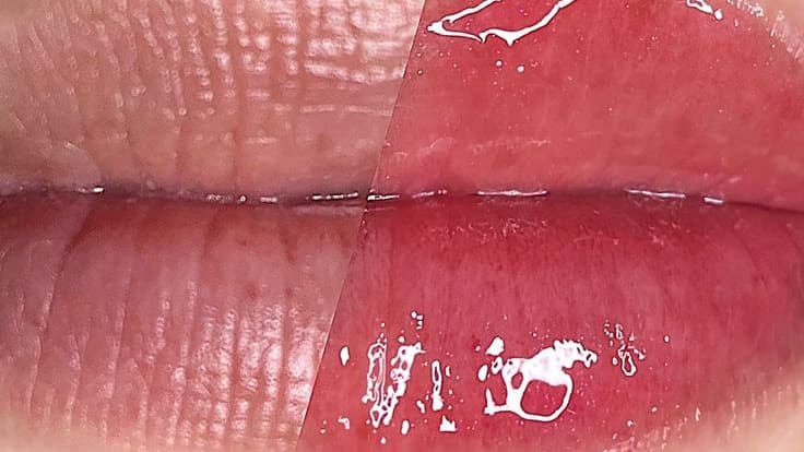 HIDRA LIPS