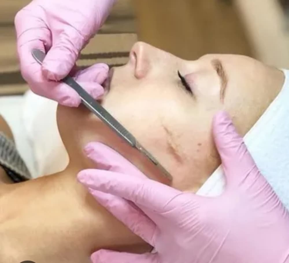 FACIALES | Limpieza facial profunda con DERMAPLANING