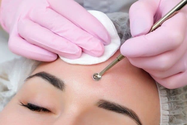 FACIALES | Limpieza profunda con EXTRACCIONES - Facial SKIN ideal para pieles mixtas/grasas o con impurezas