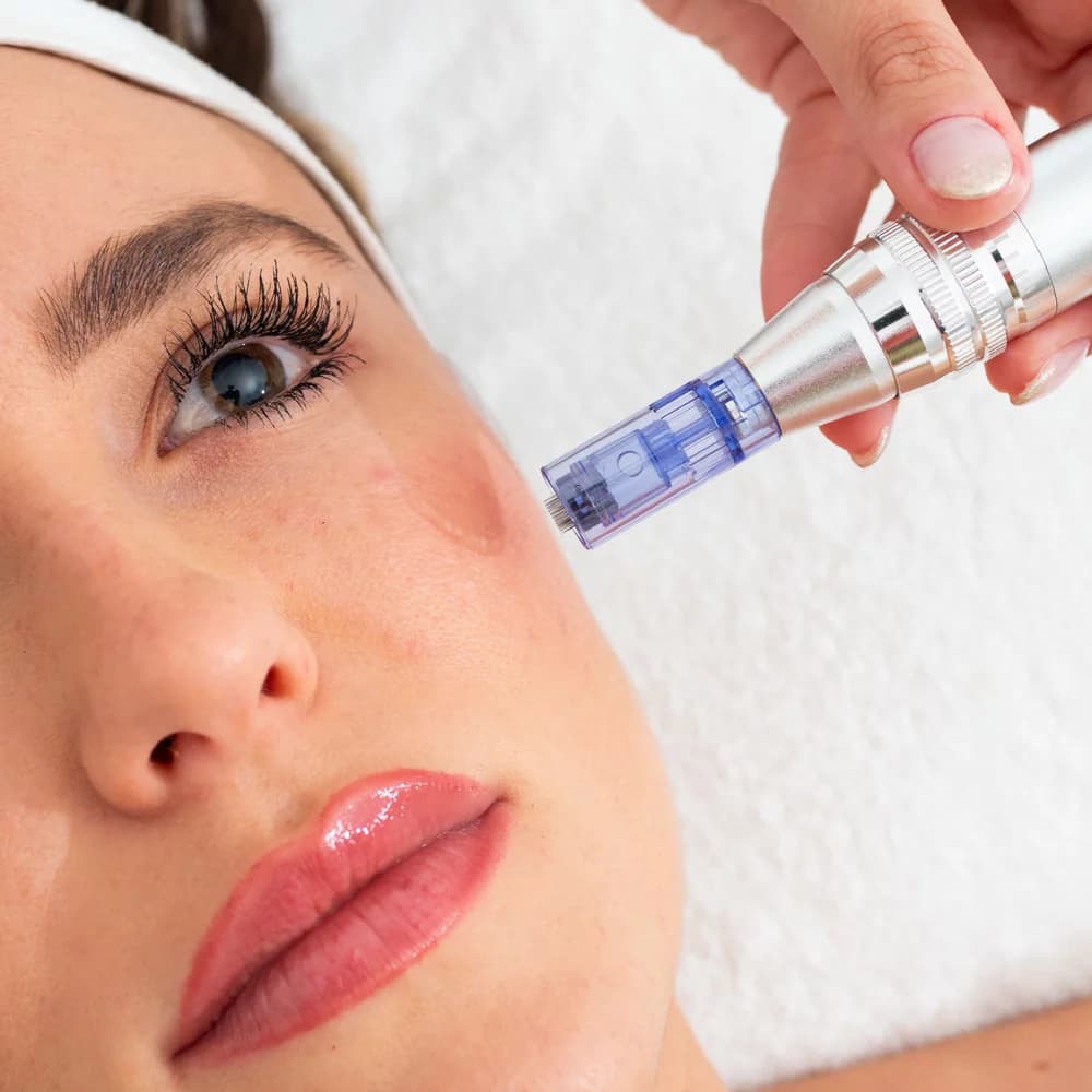 FACIALES | Dermapen