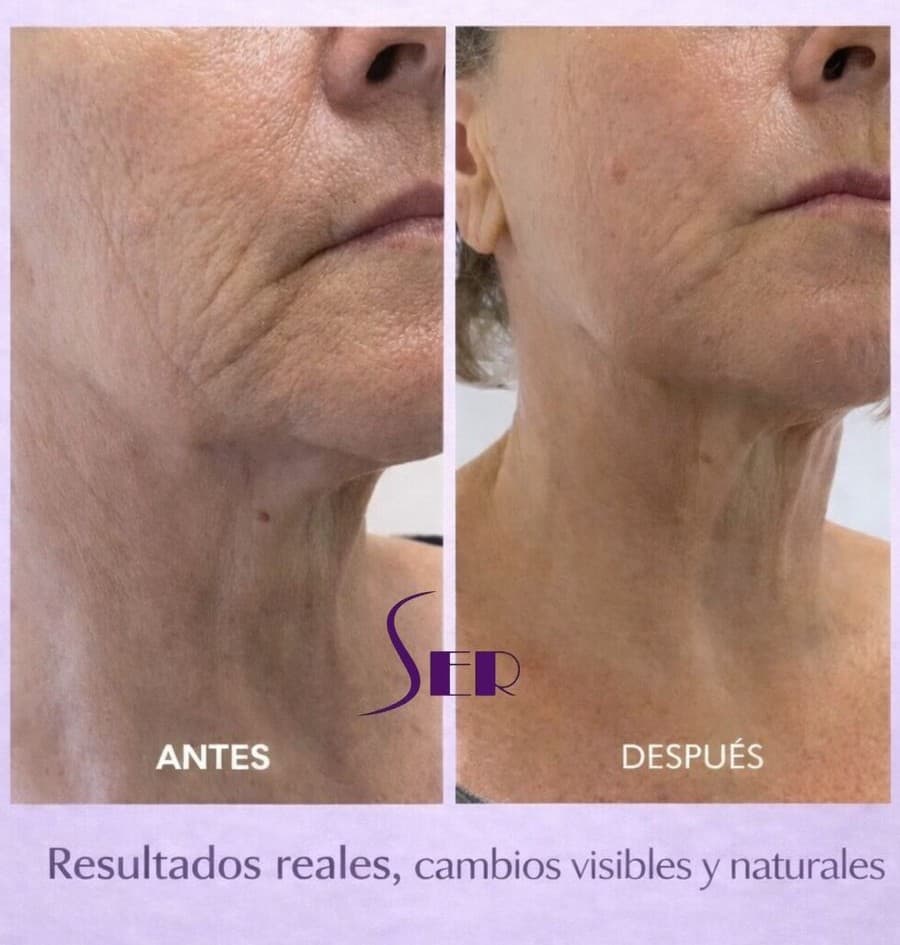 FACIALES | Plan Tensor