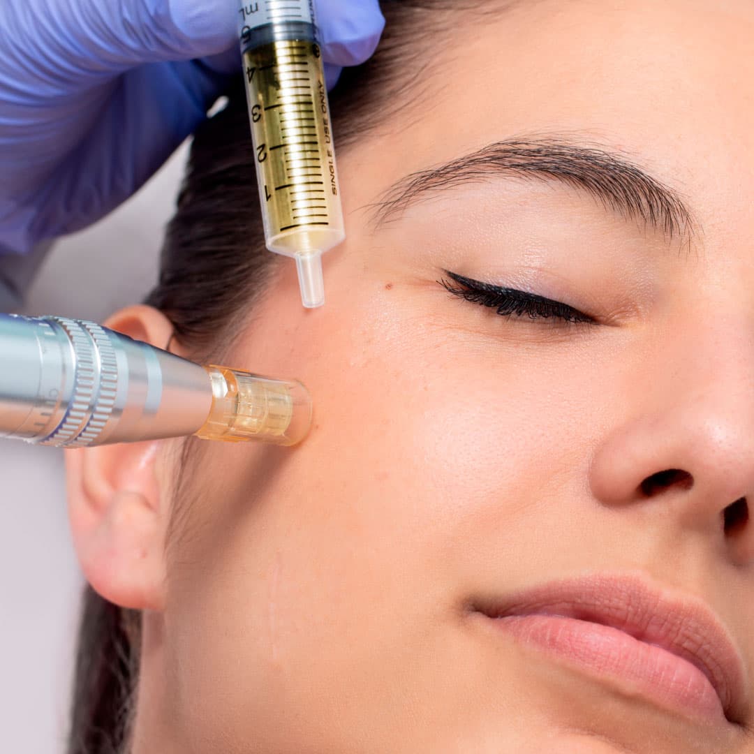 FACIALES | Exoxomas