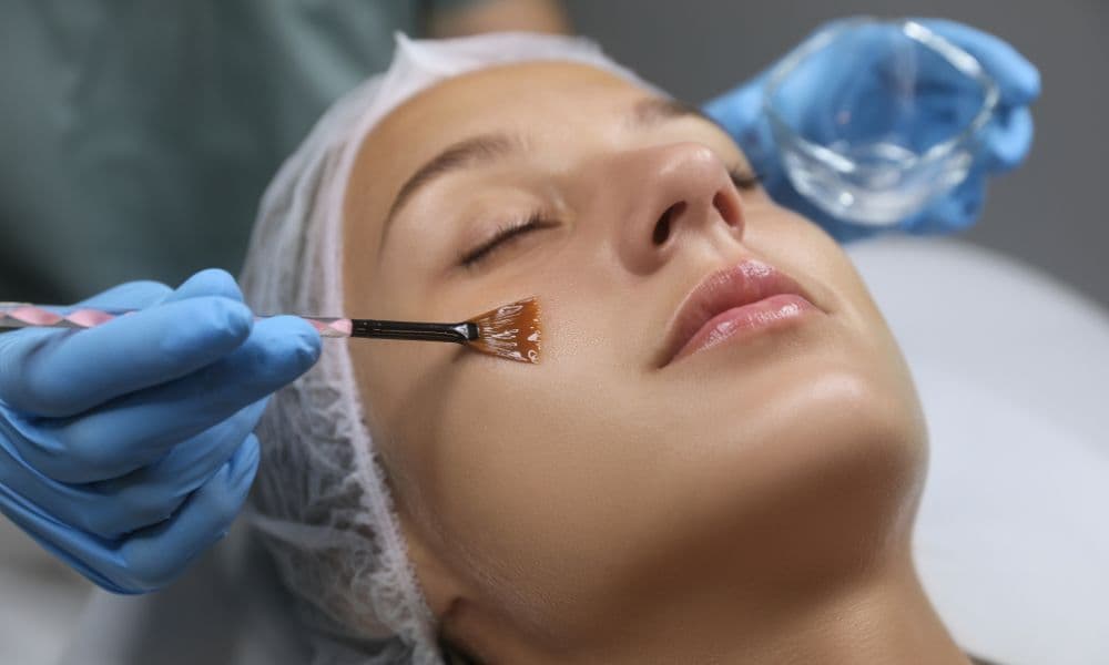 FACIALES | Peeling
