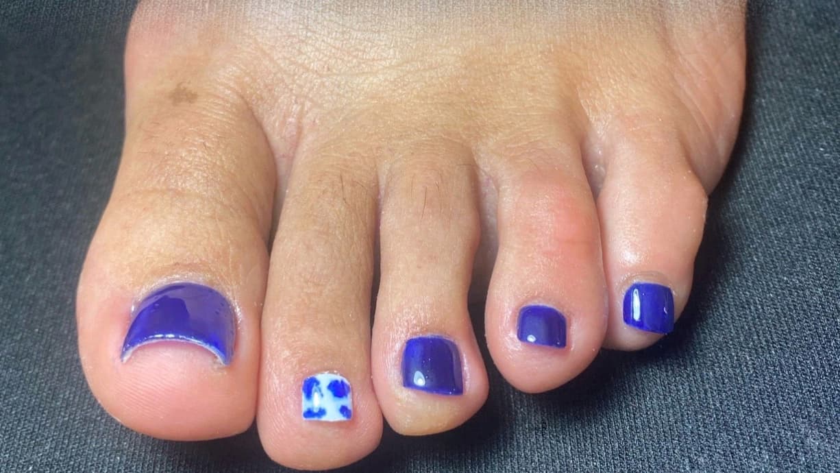 Reconstrucción y Belleza de Pies