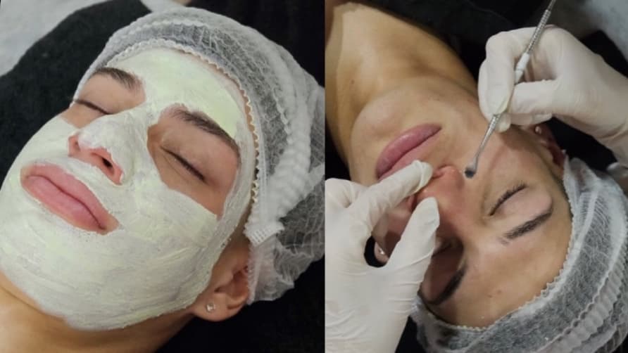 Limpieza Facial Profunda