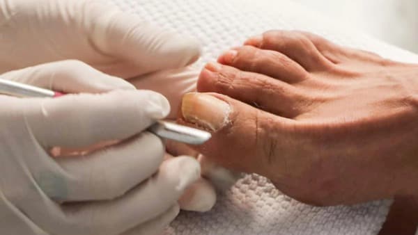 Pedicuria semi